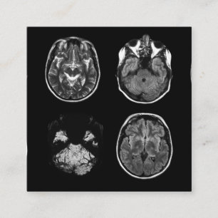 Tarjeta De Recepción Resonancia magnética cerebral