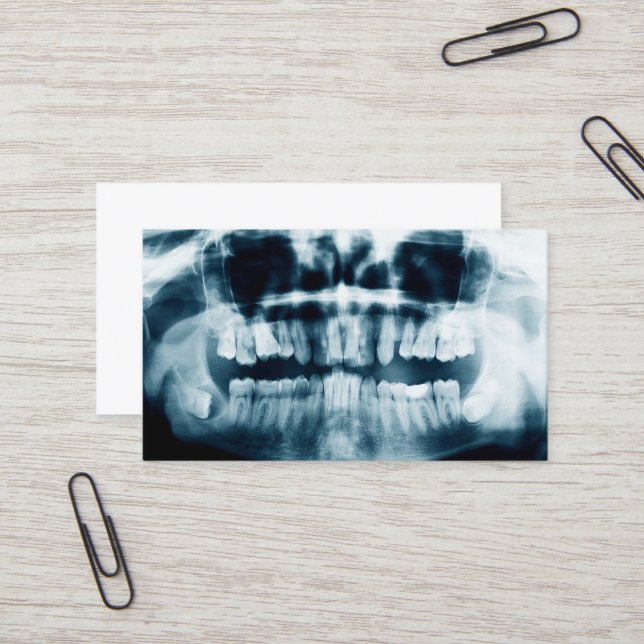 Tarjeta De Visita Rayo X de dientes (Anverso/Reverso In Situ)