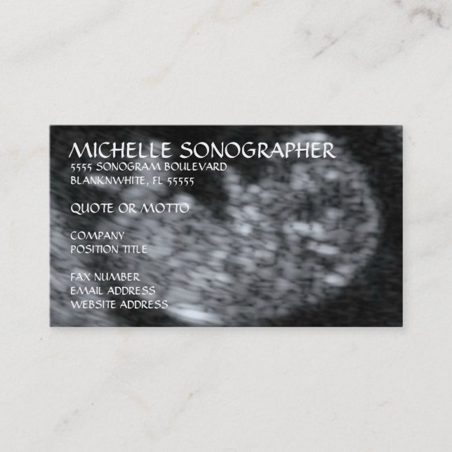 Tarjeta De Visita Sonógrafo de ultrasonido (Anverso)