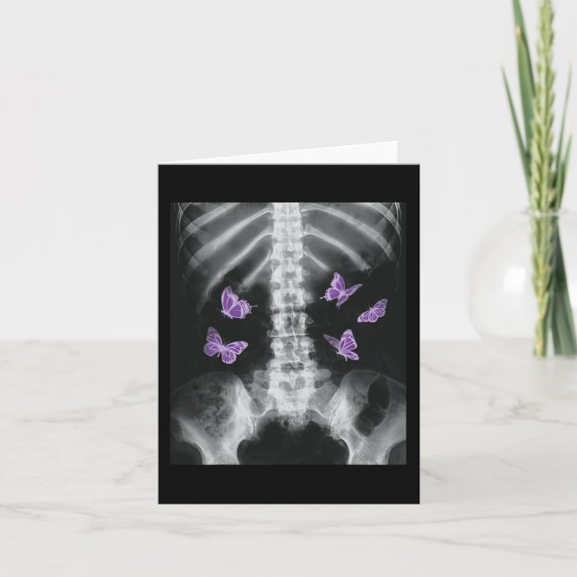 Tarjeta Egirl Xray Skeleton Pink Butterfly Harajuku y2k Da (Anverso)