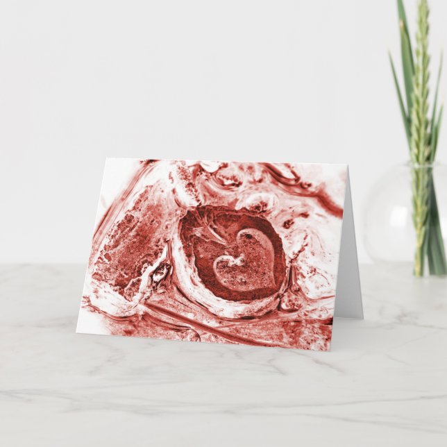 Tarjeta Festiva morir (Anverso)