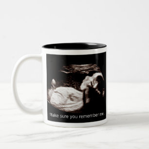 Taza Bicolor Aborto del ultrasonido: Asegúrese de le para