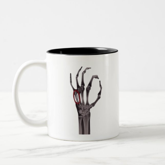 Taza Bicolor Bolas rotas Manos Skeleton X-RAY Camiseta (Izquierda)