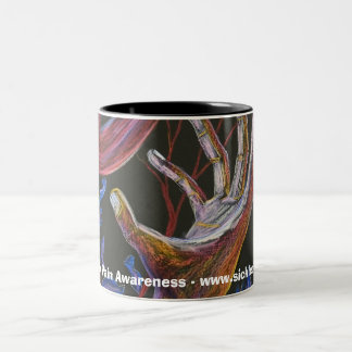 Taza Bicolor Esperanza - arte de la célula falciforme