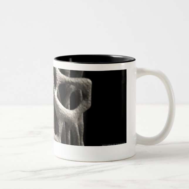 Taza Bicolor Estructura de un hueso con osteoporosis (Derecha)