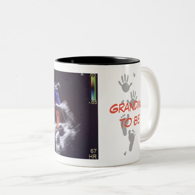 Taza Bicolor Foto de ultrasonido Abuelo para ser Mug (Anverso derecho)