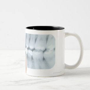 Taza Bicolor MODELO LANZADO. Radiografía dental