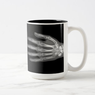 Taza Bicolor Radiografía de mano esquelética