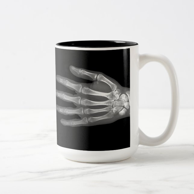 Taza Bicolor Radiografía de mano esquelética (Derecha)