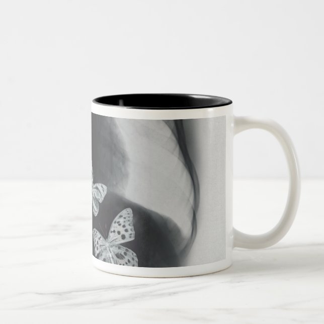 Taza Bicolor Radiografía de mariposas en el estómago (Derecha)
