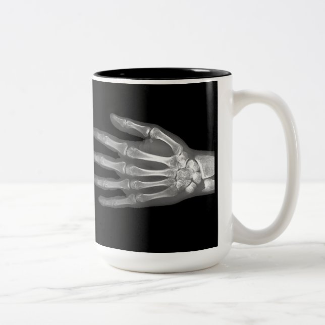 Taza Bicolor Skeleton Hand X-Ray Mug (Derecha)