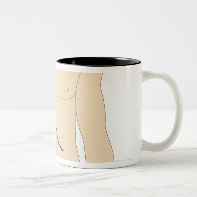 Taza Bicolor Trasplante del hígado (Derecha)