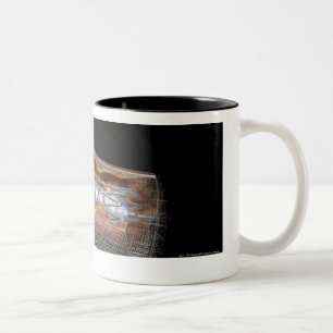Taza Bicolor Vista de un globo angioplaty en una arteria