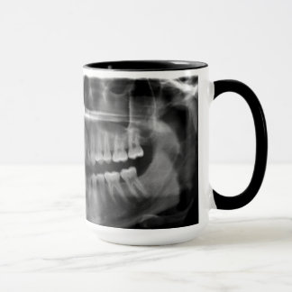 Taza Caneca Radiografia Panoramica