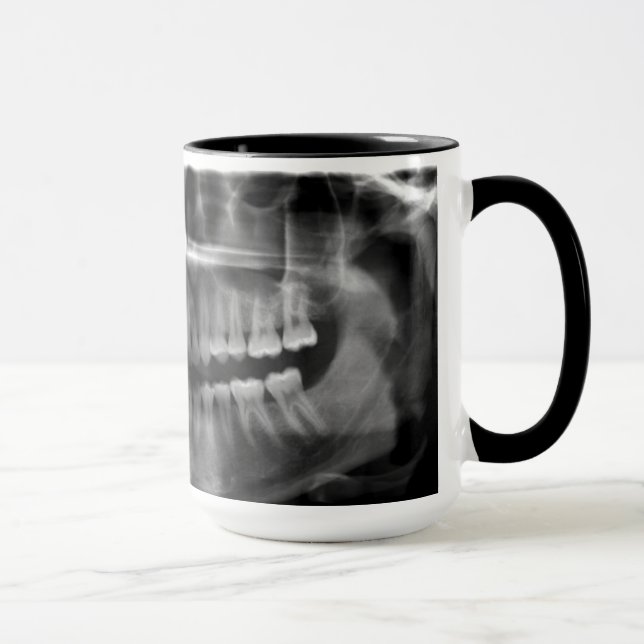 Taza Caneca Radiografia Panoramica (Derecha)