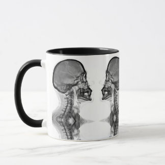 Taza Caneca Radiologica