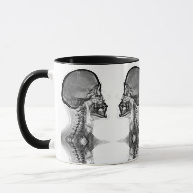 Taza Caneca Radiologica (Izquierda)