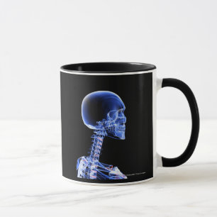 Taza Ciérrese encima de la radiografía de los huesos 