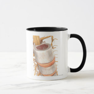 Taza Ciérrese para arriba de un disco invertebral en l