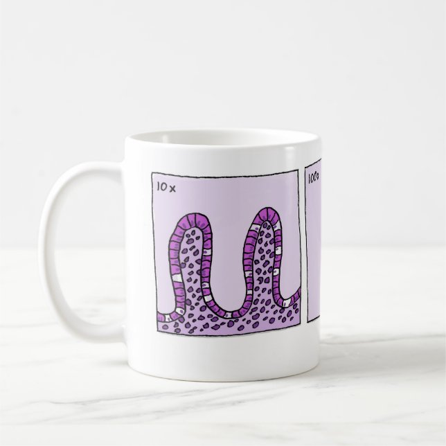 taza de 1000x Immunohistochemistry (Izquierda)