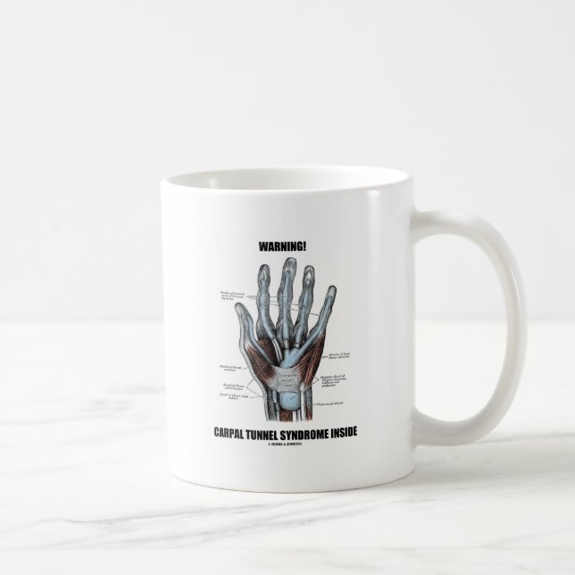 Taza De Café ¡Atención! Síndrome del Túnel Carpal en el interio (Derecha)