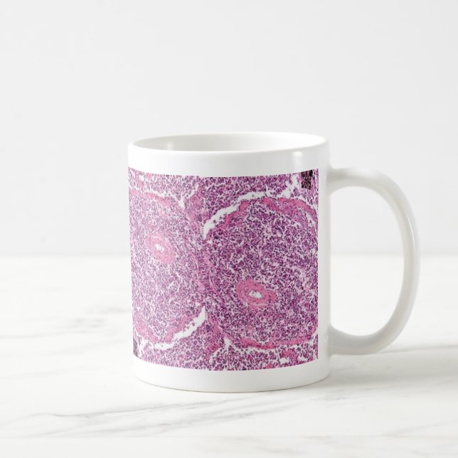 Taza De Café Células cancerosas del Taza-Pulmón de Coffe (Derecha)