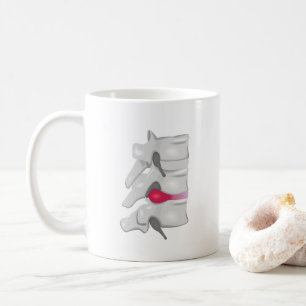 Taza De Café Cirujano de espalda quiropráctico