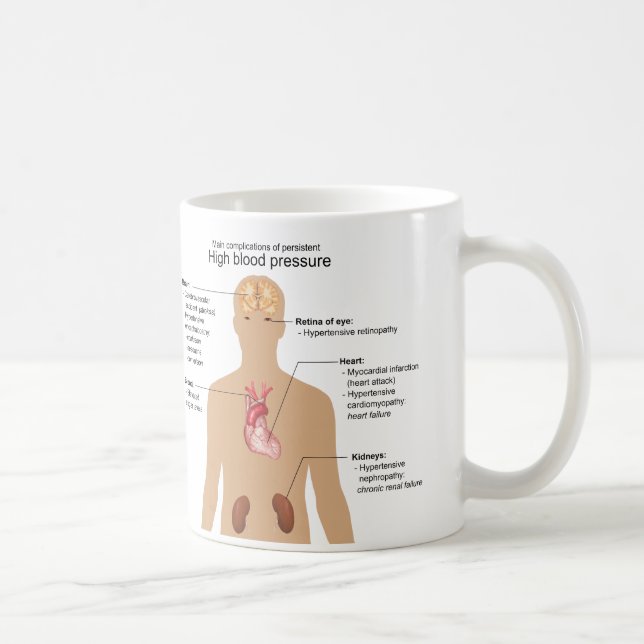 Taza De Café Complicaciones principales de la carta de la (Derecha)