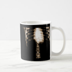 TAZA DE CAFÉ COSTILLAS ESQUELÉTICAS DEL TORSO DE LA RADIOGRAFÍA