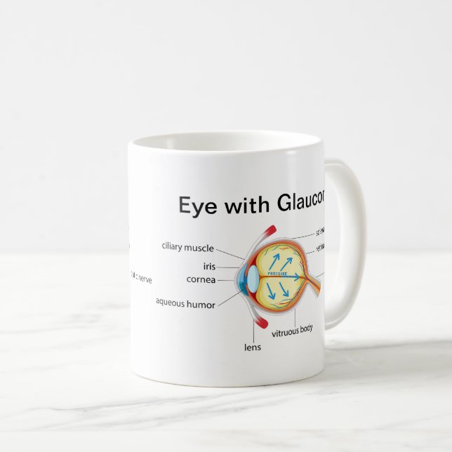 Taza De Café Diagrama ocular de Glaucoma y ojos sanos (Anverso derecho)