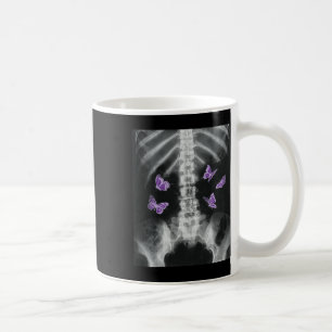 Taza De Café Egirl Xray Skeleton Mariposa Rosa Harajuku Y2k Da