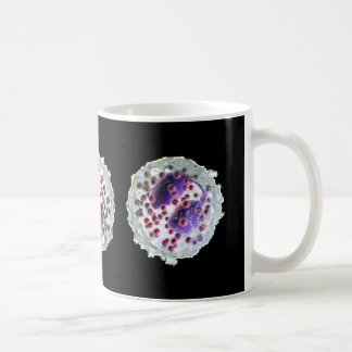 Taza de café - eosinofília