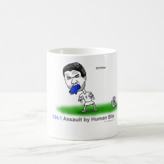 Taza De Café ICD-10: Asalto Y04.1 por la mordedura humana
