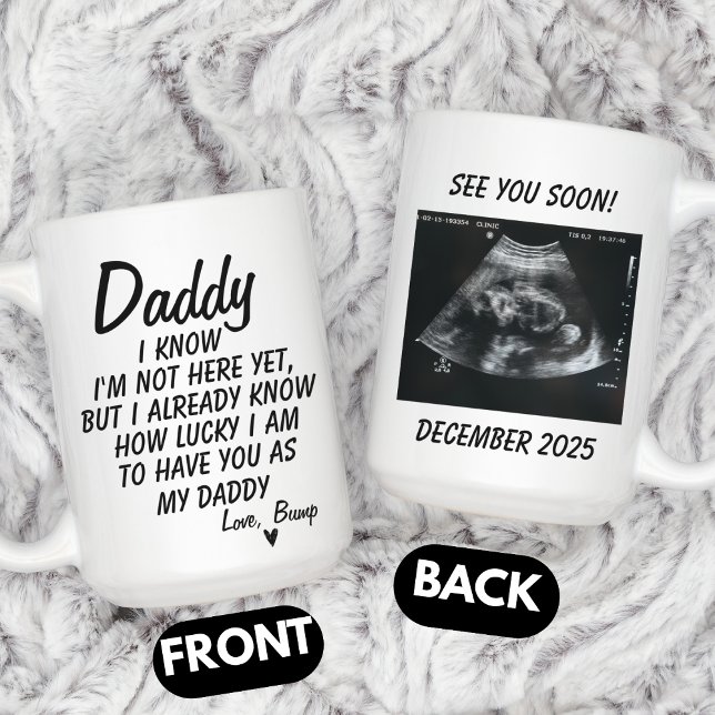 Taza De Café Personalized Sonogram Photo, Ultrasound Photo Baby (Subido por el creador)