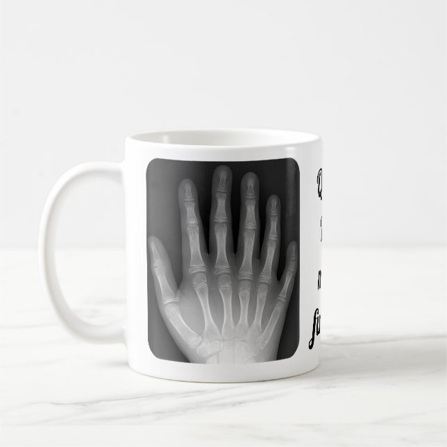 Taza De Café Radiografía polidáctila de la mano (Izquierda)