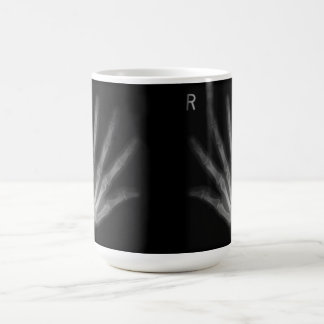 Taza De Café Rayos X digitales extra a la derecha e izquierda