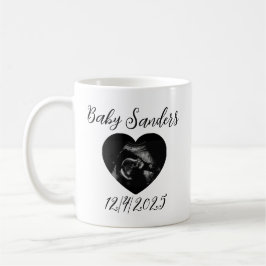 Taza De Café Sonograma de bebé personalizado Mug - Ultrasonido 