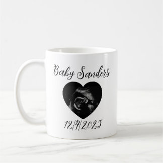 Taza De Café Sonograma de bebé personalizado Mug - Ultrasonido