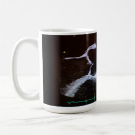 Taza De Café Válvula aórtica doppler copo ecocardiograma