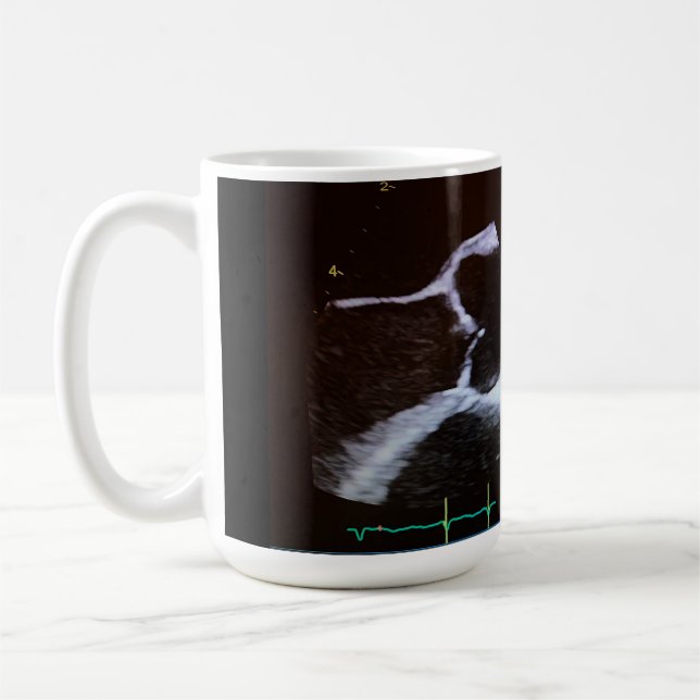 Taza De Café Válvula aórtica doppler copo ecocardiograma (Izquierda)