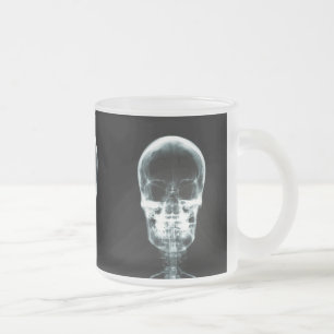 TAZA DE CRISTAL ESMERILADO CRÁNEO ESQUELÉTICO DE VISION DE LA RADIOGRAFÍA -