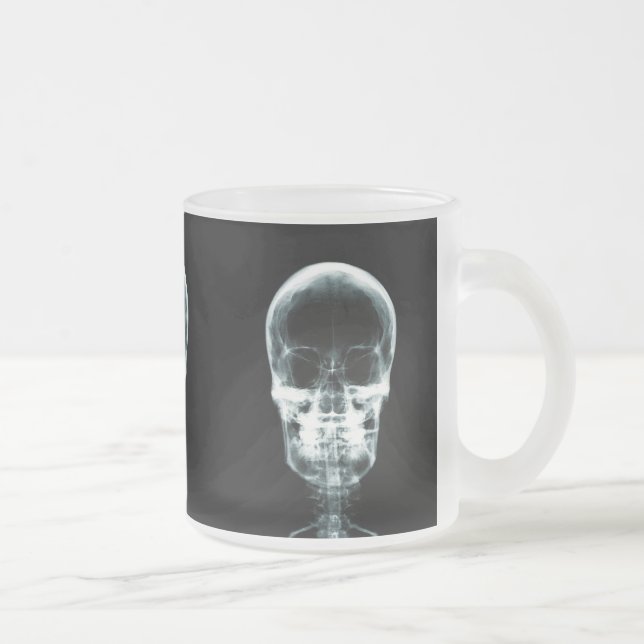 TAZA DE CRISTAL ESMERILADO CRÁNEO ESQUELÉTICO DE VISION DE LA RADIOGRAFÍA - (Derecha)