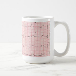 Taza de ECG