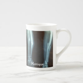 Taza De Porcelana Radio roto y rayos ulna "Tiempo de descanso"