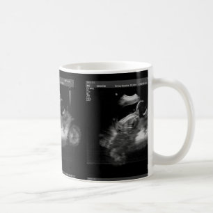 Taza del Sonogram de la motocicleta