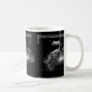 Taza del Sonogram de la motocicleta