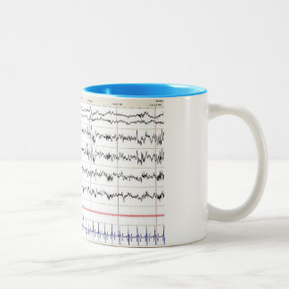 Taza del sueño EEG - sueño de la etapa 2