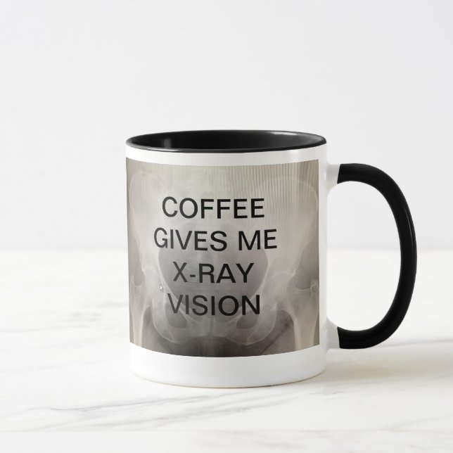 TAZA EL CAFÉ ME DA LA RADIOGRAFÍA VISION (Derecha)