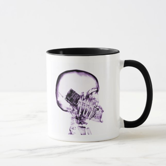 TAZA ESQUELETO DE LA RADIOGRAFÍA EN EL TELÉFONO - (Derecha)
