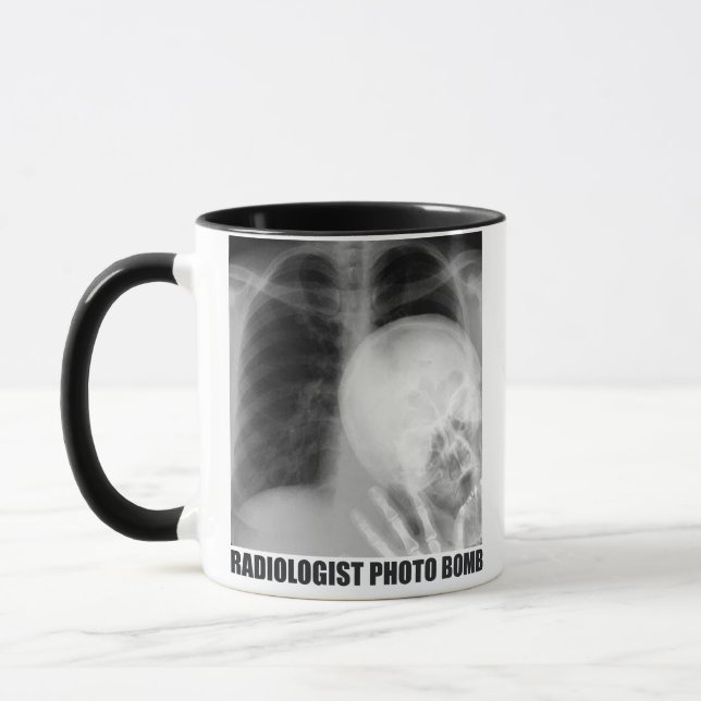 TAZA FOTO RADIOLOGISTA BOMBA (Izquierda)
